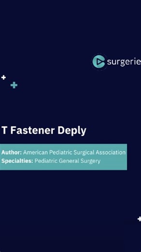 CSurgeries | Surgical Training Platform | T Fastener Deploy demonstrates the step-by-step technique for deploying T-fasteners during endoscopic gastrostomy tube placement. The... | Instagram