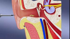 Ear Wax Removal Tool Camera, Ear Cleaner with Ear Pick & Tweezers, Ear Camera with 10 Megapixels, 12 Ear Spoons, Earwax Removal with 2 Modes, Ear Wax Removal kit for Ear Cleaning