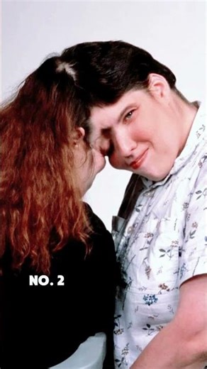 3 celebrities you didn't know were conjoined twins#usa #celebrity #fyp #hollywood #famous #twins