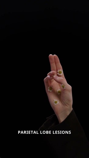 Your Hand Wants To Choke You! 🤯 Alien Hand Syndrome