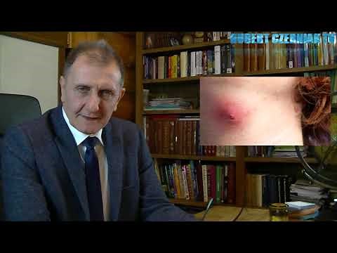 Hubert Czerniak TV #22 Cukrzyca - wszystko, co musisz wiedzieć