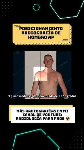Posicionamiento para radiografía de Hombro AP