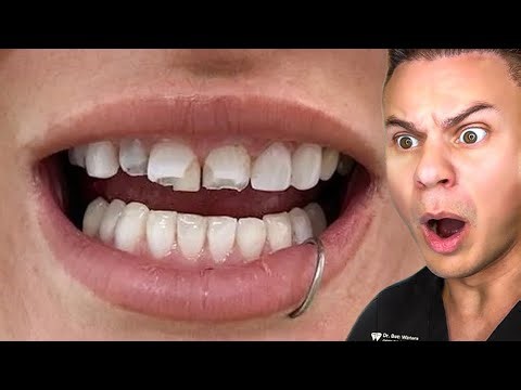 Orthodontist Reacts To WEIRDEST Teeth On TikTok