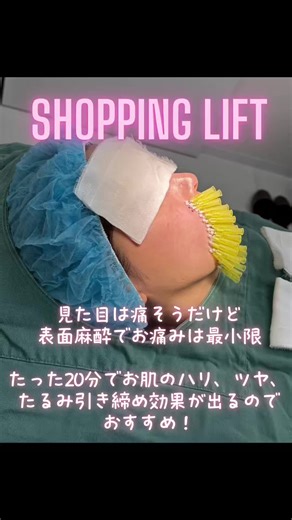 【ショッピングリフト✨】 軽度のたるみが気になっている友人に私がまずはおすすめするのがショッピングリフトです✨✨ もちろんしっかり引き上げたいならアルテミスリフトですが、美容医療への入門編としてもお手軽で、ダウンタイムも短くて綺麗になれる❣️おすすめです✨✨ 🌟ショッピングリフトとは🌟 ①皮下〜筋膜層に極細針を挿入しリフトアップする施術です。痛みや腫れ、内出血が出にくく、施術後、そのままショッピングに行けるくらい気軽に施術を受けられるということからショッピングリフトと呼ばれています。 ②お悩みに合わせて顔、フェイスライン、首などピンポイントにオーダーメイドのリフトアップが可能です。 ③ 1〜2年ほどコラーゲン増生効果、引き締め効果が持続します。 ④同時に糸リフトやヒアルロン酸などとのです。 当院ではショッピングリフトのモニター様を期間限定で募集しております。是非、この機会にお手軽なリフトアップ体験をしてみませんか⁉️ 施術の詳細に関しましては、プロフィールにあるリンクからラクルのウェブサイトをご覧くださいませ🖥📱 モニター様をご希望の場合は、ウェブサイトの応募条件の規約をご確認