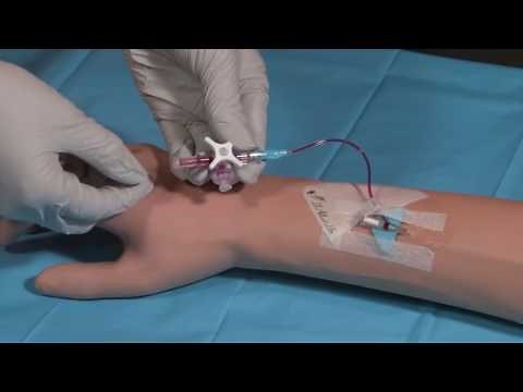 Becton Dickinson Nexiva IV System Review