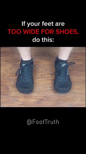 Tag a friend that has wide feet. #footpain #shoeschange #shoes #podiatry