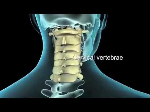 Laminectomy Procedure