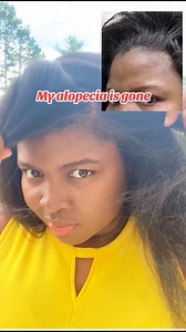 13K views · 324 reactions | SALE la ap fini vendredi sa a. Pa kite stock yo gentan fini sanw pa pran pwodui cheve, pwodui po ak lip gloss paw. Tout net gen diskont Sou TIKTOK menm@Gen free shipping sou set yo #cherichout #turmericskincare #skincare #haircare #healthyhair #hairgrowth #cherichoutqueens | Tami Haïti | Facebook