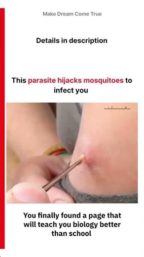 🪱 This parasite hijacks 🦟 mosquitoes to infect you 🩺 | MDCT