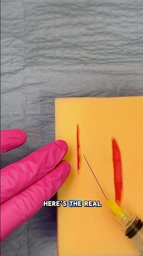 Same Drug, Different Risk - 1% vs 2% Lidocaine 🤔#pastudent #npstudent #howtostitch #howto