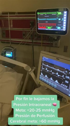 Understanding Heart Rate Monitoring with CAMINO ECG