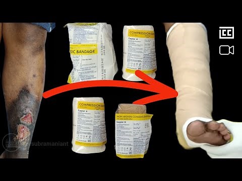 How to apply four layer compression bandage system?