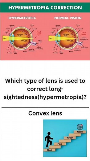 Which type of lens is used to correct long- sightedness (hypermetropia)?