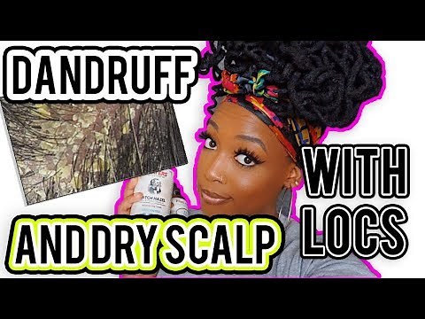 HOW TO GET RID OF DANDRUFF/DRY SCALP WITH LOCS