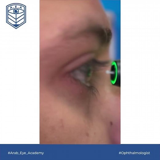 Educational Video 10: Rebound tonometer (I Care) by AEA