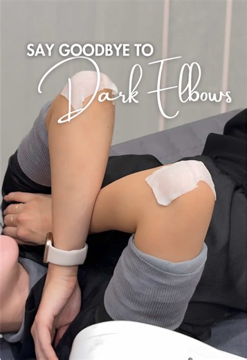 POV: you finally decided your dark elbows don’t deserve to be in their villain era anymore 😌🖐️ One session later and suddenly I’m wearing sleeveless tops like it’s a personality trait. ✨ Treatment: Secret Peel An advanced body exfoliating peel designed to gently remove dead skin, brighten hyperpigmentation, and improve skin texture elasticity. It uses LHA, patented brightening ingredients (H2SOL™ & QPT™), plus gold & diamond extracts for extra glow — with zero harsh peeling. Bonus? Every Secre