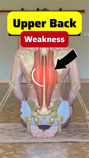 Upper back pain exercises ✅ | #physiowaladoctor #upperback #upperbackpain #upperbackworkout