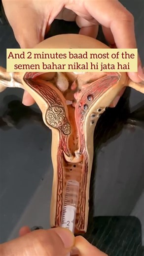 Dr. Manpreet Patel on Instagram: "Here’s how to calculate your fertile window⬇️ Use the calendar method to track the length of your menstrual cycle. 🩸Each month, mark the first day of your period on a calendar or in a period-tracking app. 🩸The number of days between the first day of consecutive periods is the length of your menstrual cycle. You should do this for at least six months to get good data. 🩸You ovulate about 12 to 14 days before the start of a new menstrual cycle. ✔️Your fertile wi