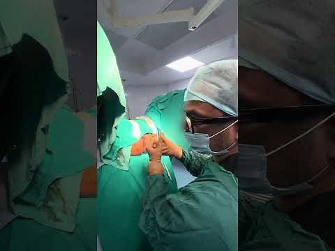 Anal Stenosis? What is it? Understanding anal Stricture after Operation ? | Dr ASHISH BHANOT