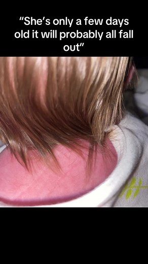 Hair Transformation After Pregnancy: My Experience