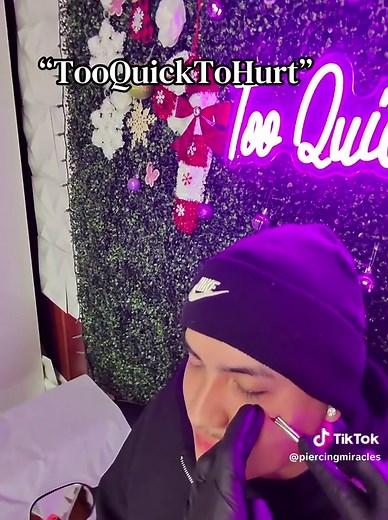 Facial Dermal Videa (Benefits of the needle- quicker healing , less pain, no chunk of skin removal, decreased rejection rate)