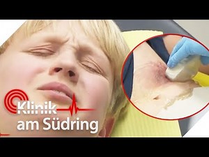 Felix (11) blutet in der Bauchhöhle! Wie ist die Verletzung entstanden? | Klinik am Südring | SAT.1