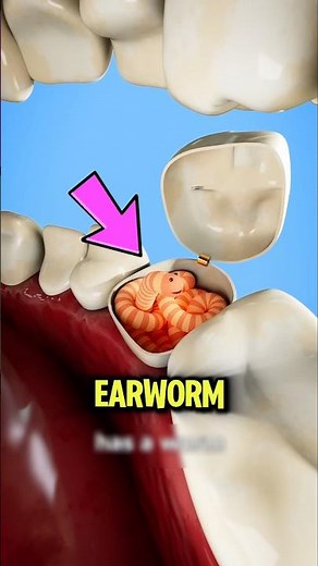If This Worm Enter Your Ear...Do This Fast!😱