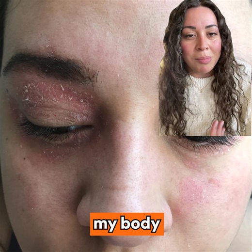 4.7K reactions · 584 shares | After using Glycoproteins by clearing...