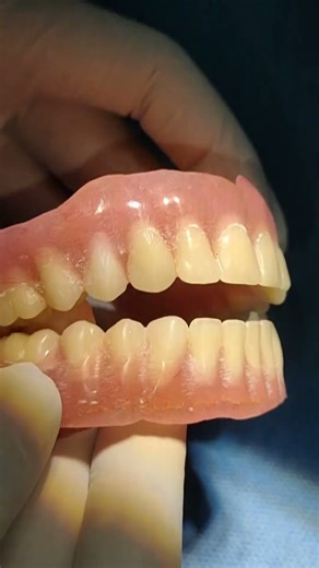 Complete denture. New beginnings 🌟🩵🌸🥳 #sitamarhi #dentalmakeover #completedenture #prosthodontics