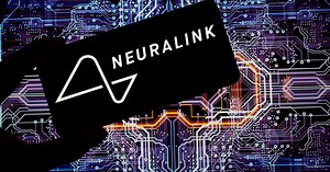 "Neuralink" looks to implant chips into the brain