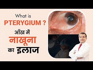 What is Pterygium? | Causes, Symptoms & Treatment of Eye Growth