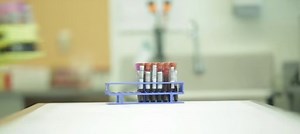 7 Pros and Cons of Donating Blood