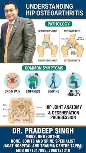 Hip Pain, understanding hip pain due to osteoarthritis # osteomalacia, #osteoarthritis hip,# hippain