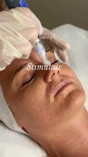 Designed to rejuvenate your complexion after the harsh winter, our Spring Skin Package combines a clinical peel, collagen-stimulating skin needling, and healing LED light therapy in one session to refine texture, and restore your skin's natural radiance. All treatment packages are 20% off RRP. Head over to the link in bio to book! | Face Factor