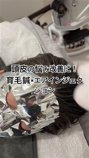 薄毛・抜け毛が気になる方必見！育毛鍼×エアインジェクションで頭皮から変える新発想ケア #薄毛治療 #抜け毛 #抜け毛対策 #育毛 #頭皮ケア #髪のボリューム #髪が細い #女性の薄毛