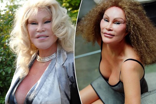 Socialite Jocelyn Wildenstein, known as ‘Catwoman,’ reveals pre-plastic surgery face in shocking throwback photo