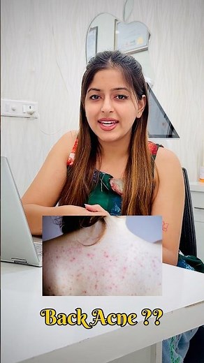 “Back Acne? 😩 Try These 3 Game-Changing Habits for Clear, Smooth Skin
