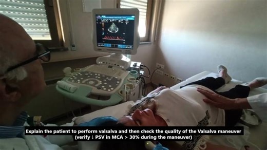 Bubble Test Using Transcranial Color-Coded Doppler (TCCD) | Mohan Sai Gudela, DM