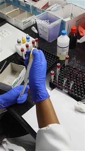 Comment process... #viral #lab #mbbs #education #blood #pathology #tranding #histology #biochemistry #tataseira | Labwala22