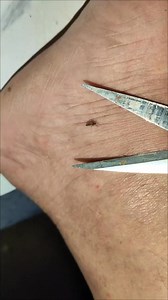 Essential Oils vs. Mosquitoes: What Works Best? . . . . . #mosquito #mosquitoes #mosquitobites #mosquitorepellent #mosquitokiller #mosquitos #mosquitocontrol #culicidae #EssentialOils #BugRepellent | Lexus Pet Boutique