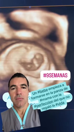 #increíble cómo puede verse un #bebe a las #9semanas de #embarazo . A prepararse las#mamas para recibirlo😍‼️