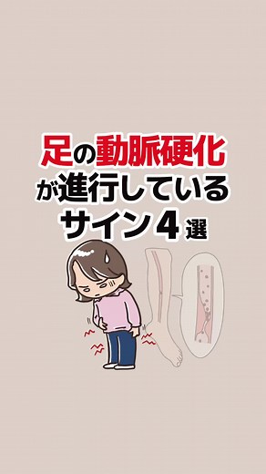 足の動脈硬化の進行サイン4選