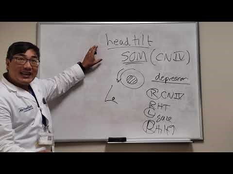 Head Tilt in 4th Nerve Palsy