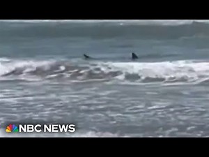 Texas shark attack survivor speaks out