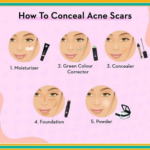How To Cover Acne Scars!!