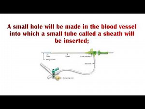Angiogram Procedure - What Is An Angiogram Procedure For The Heart