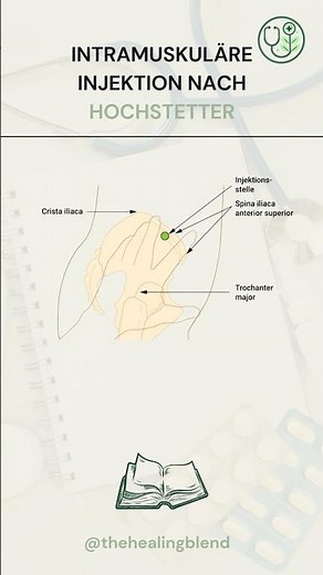 💉 Wo genau wird bei der i.m.-Injektion nach Hochstetter gestochen? #medizin