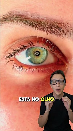 Bolha de Ar no Olho 😱#medicina #medico #enfermagem #oftalmologia #oftalmologista catarata glaucoma