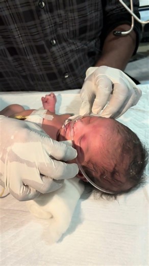 Chestryped for newborn baby😌 #sumitnicunursingstm #youtubeshorts #nursin #newbornbaby #chestworkout