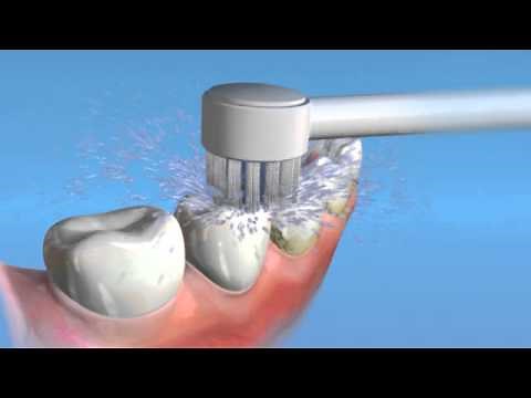Waterpik™ Toothbrush Tip (TB-100E)